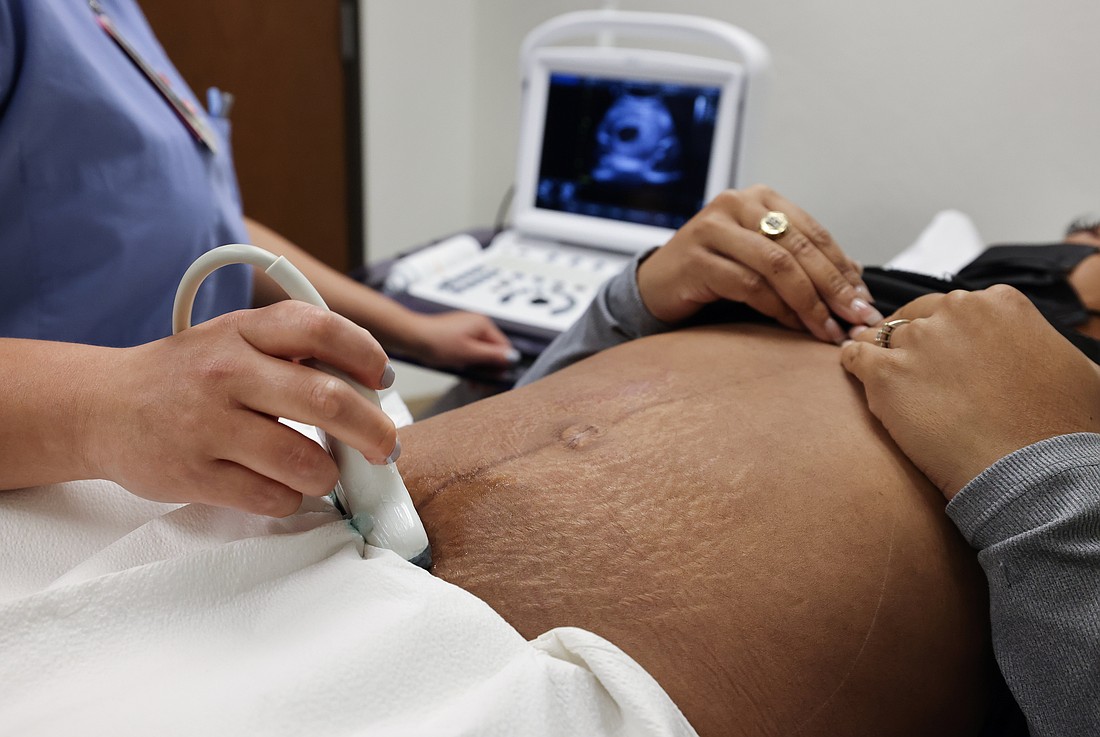 20240807T0600 CLI ABORTION HEALTH CARE 1780355_t1100